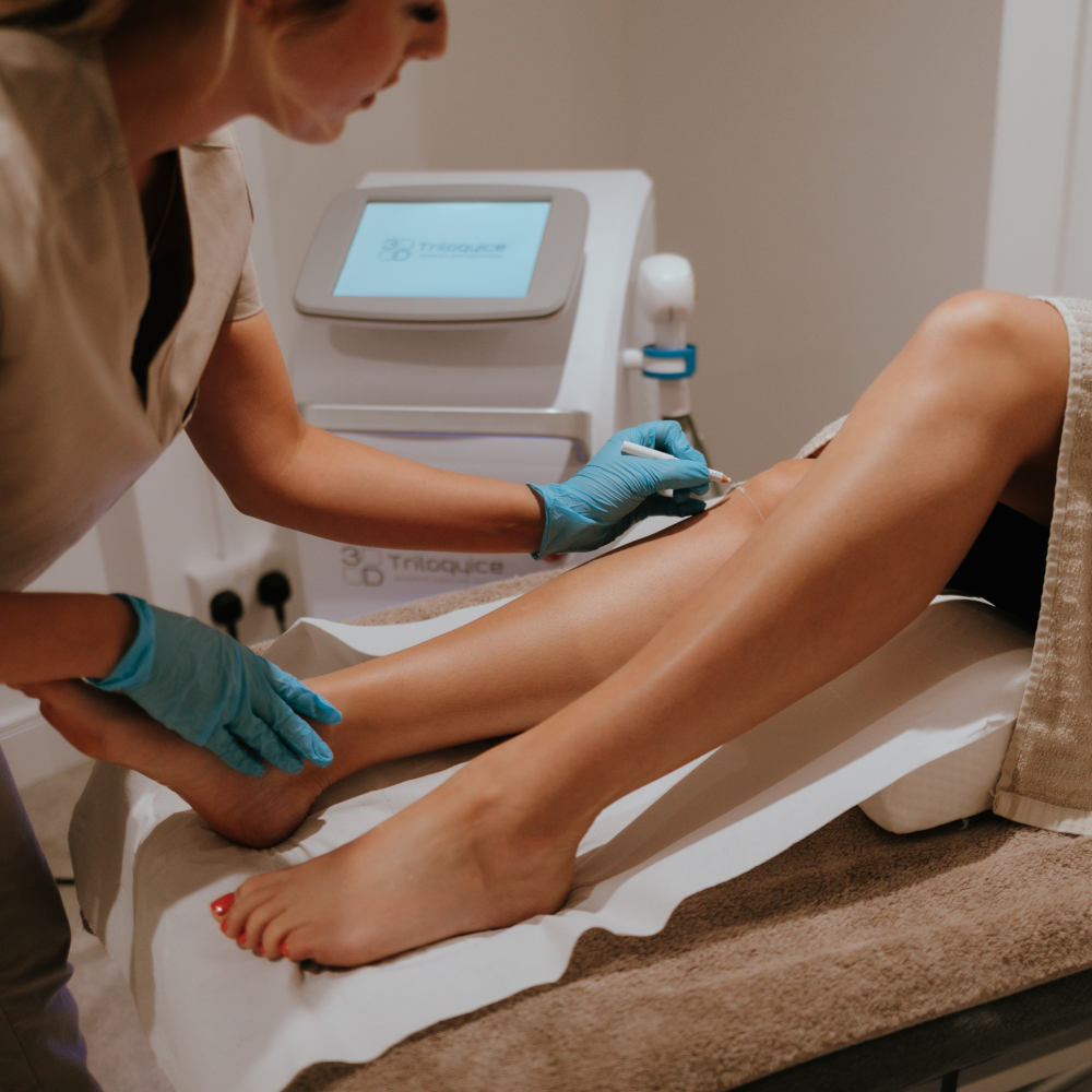 Laser treatments Brighton